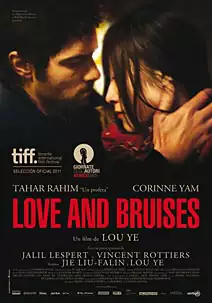 Love and bruises