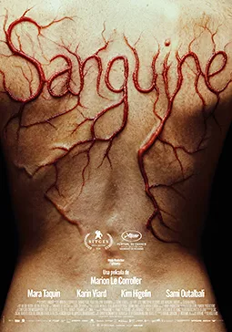 Sanguine